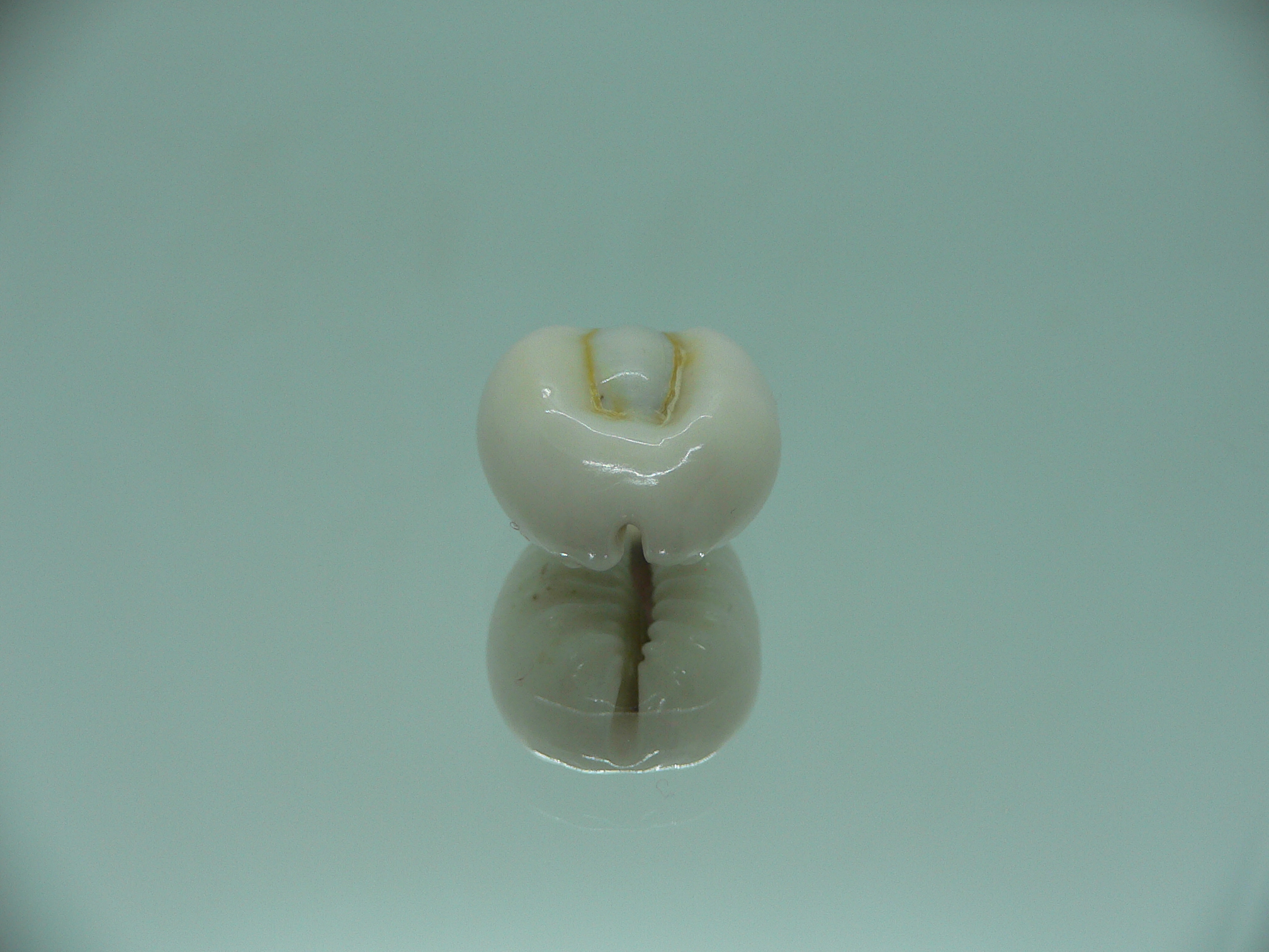 Cypraea obvelata perrieri (var.) WIDE & OREOL