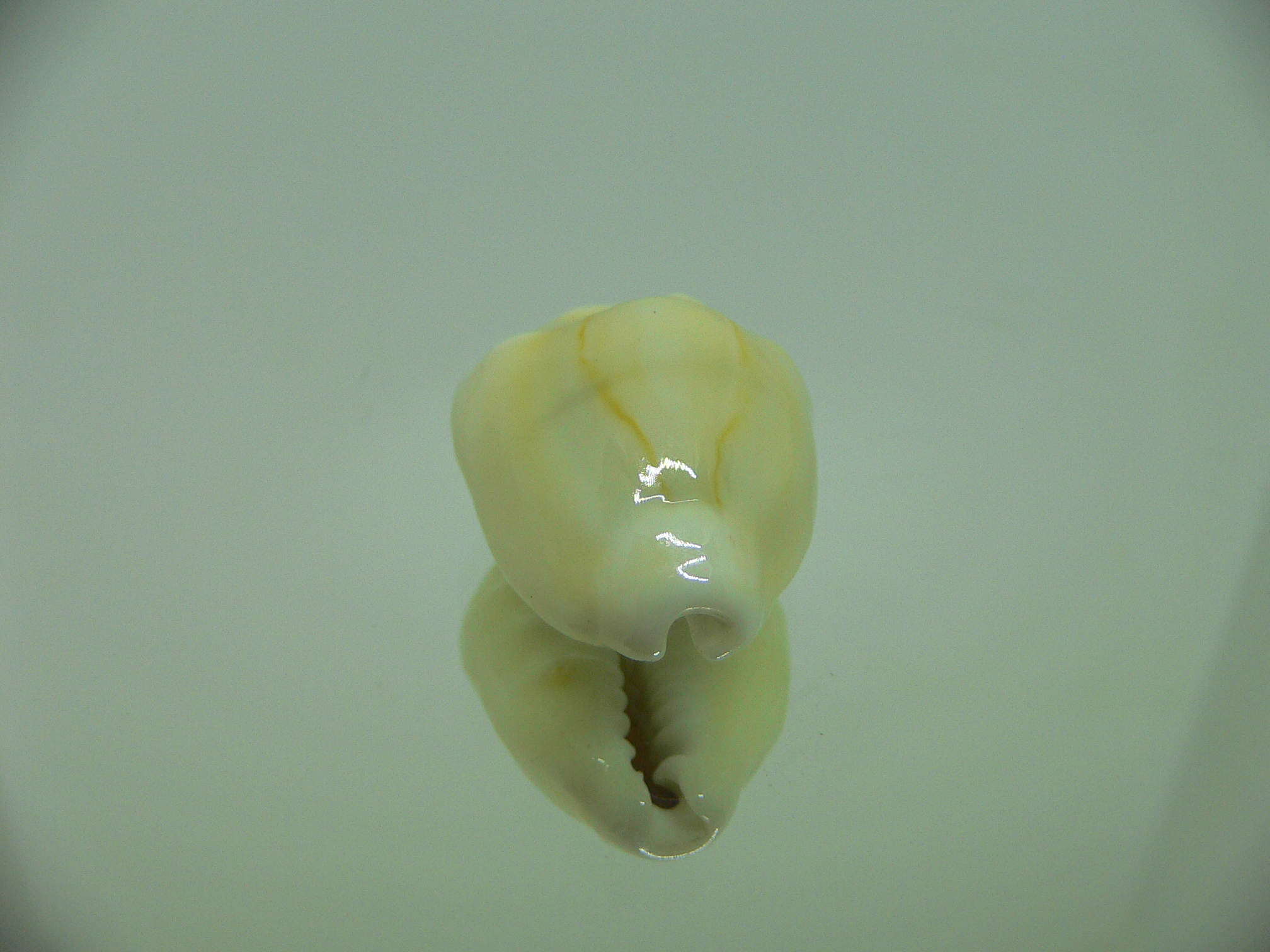 Cypraea moneta tuberculosa (var.) GIANT & CALLOUSED