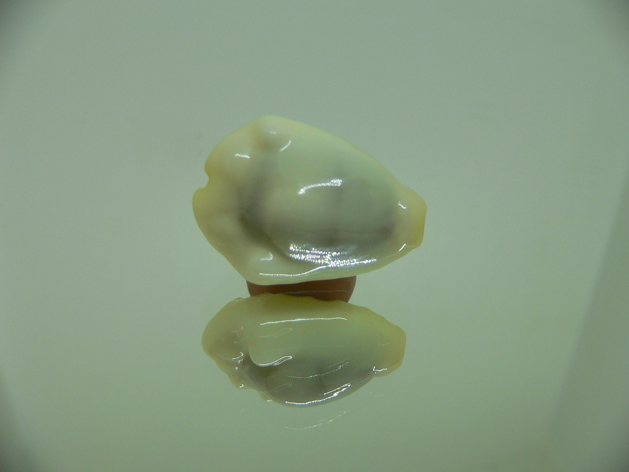 Cypraea moneta tuberculosa (var.)12