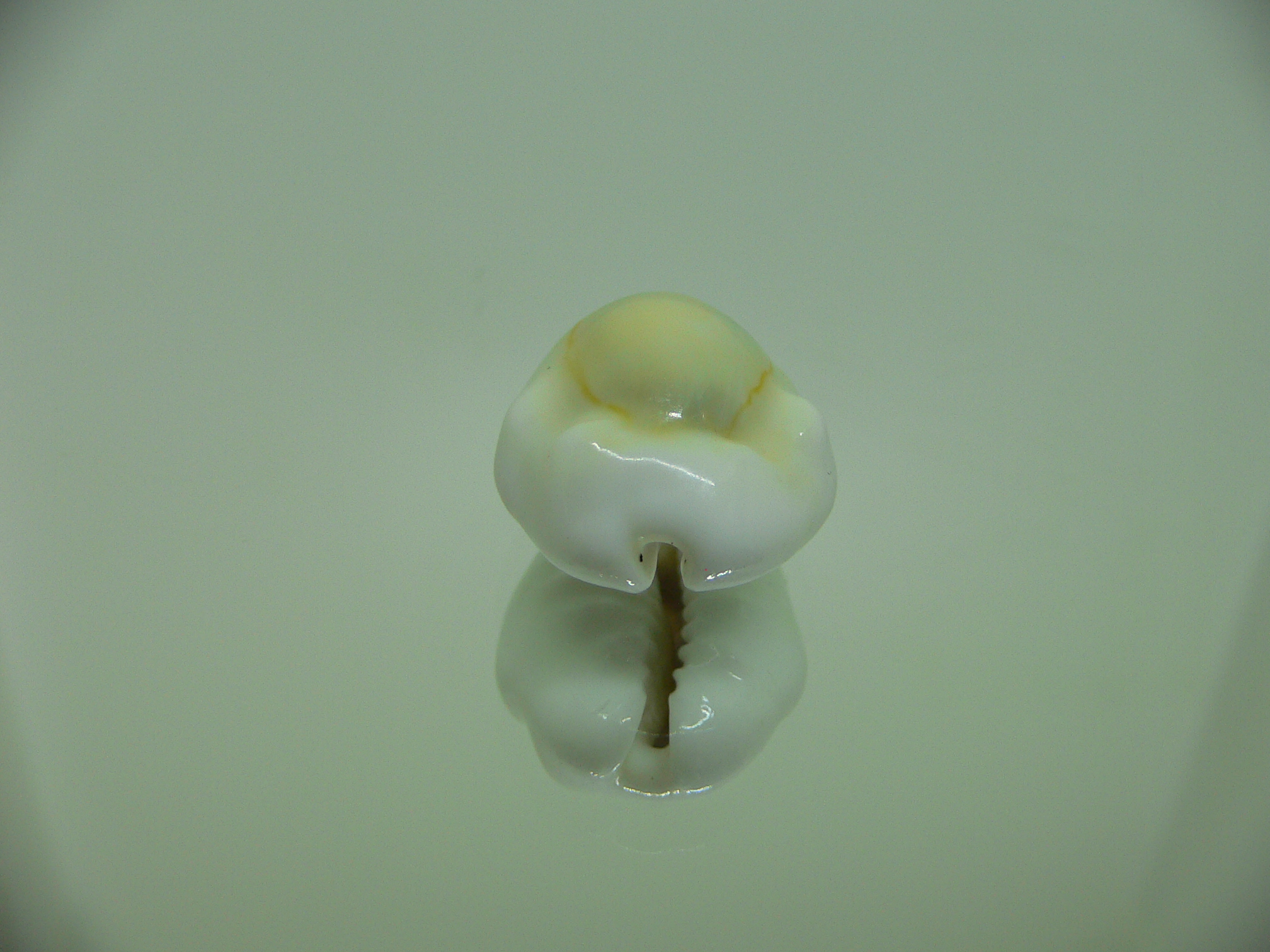 Cypraea moneta tuberculosa (var.) 10