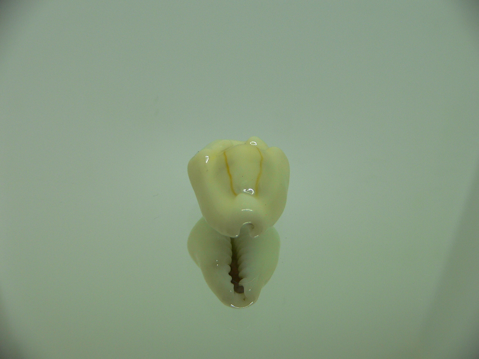 Cypraea moneta tuberculosa (var.) 2