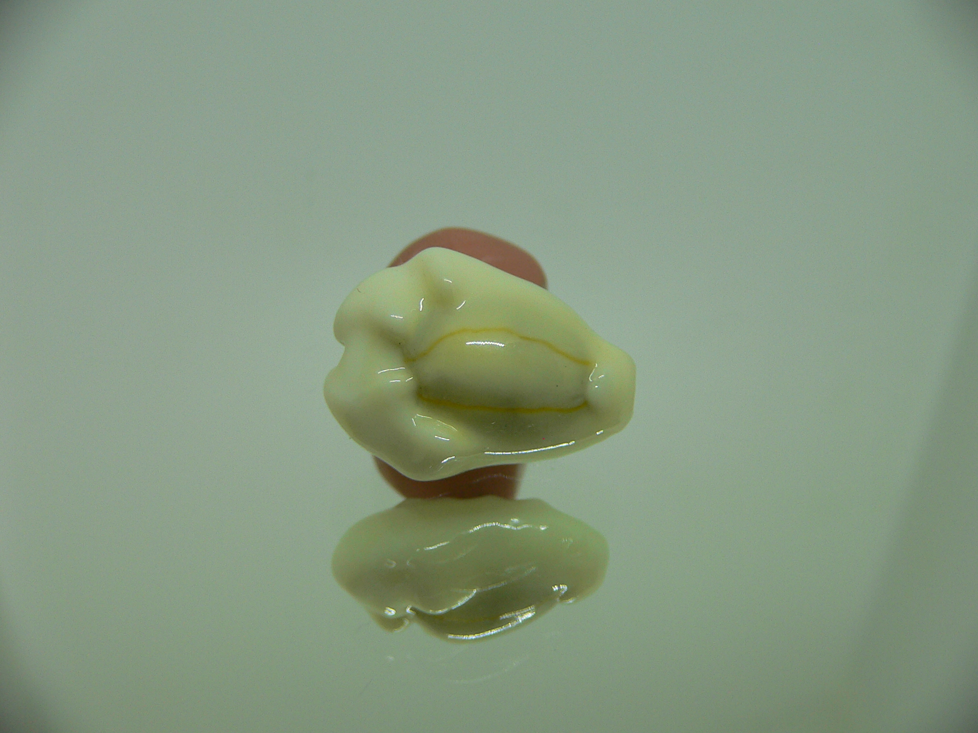 Cypraea moneta tuberculosa (var.) 2