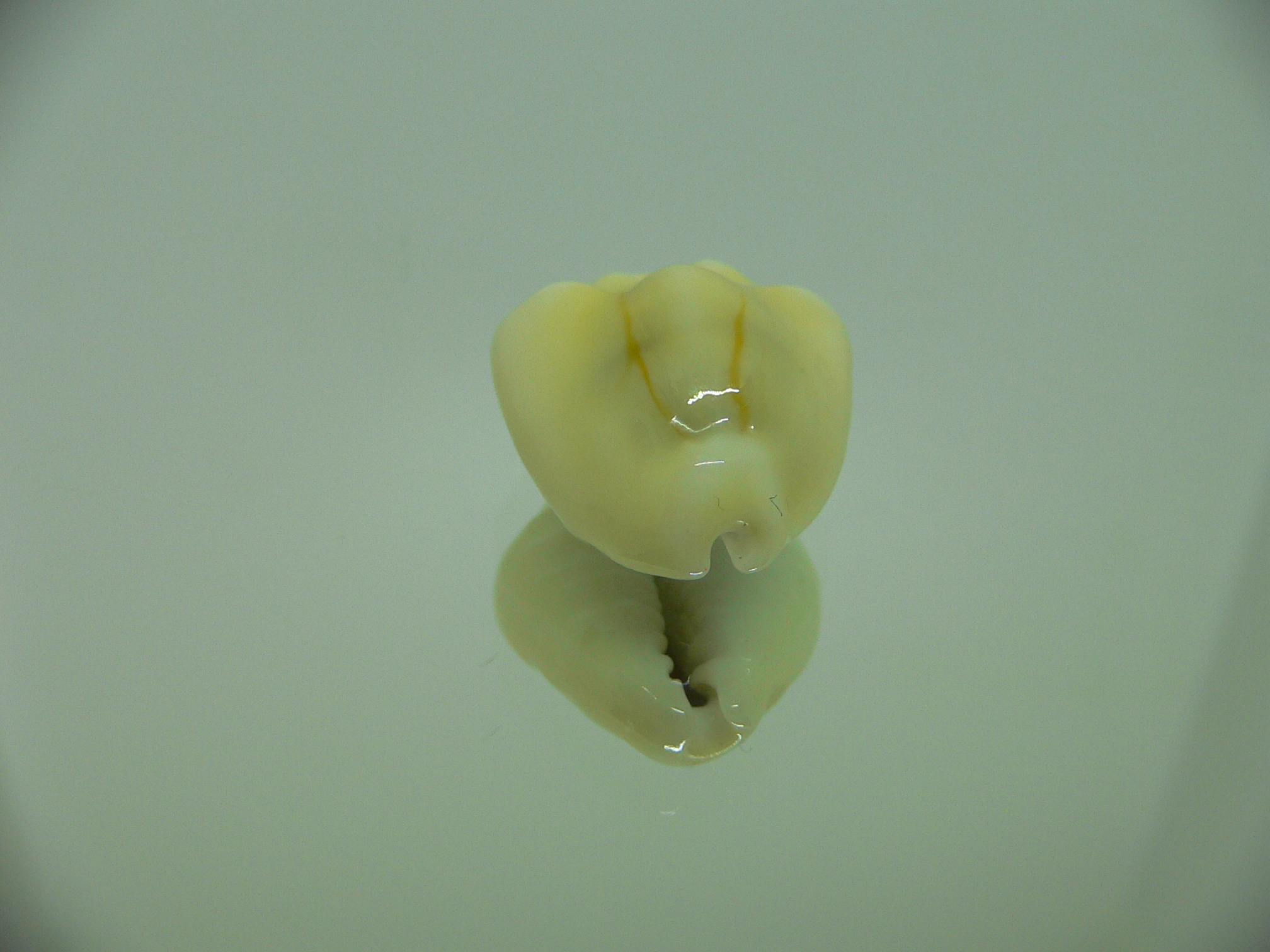 Cypraea moneta tuberculosa (var.) 9