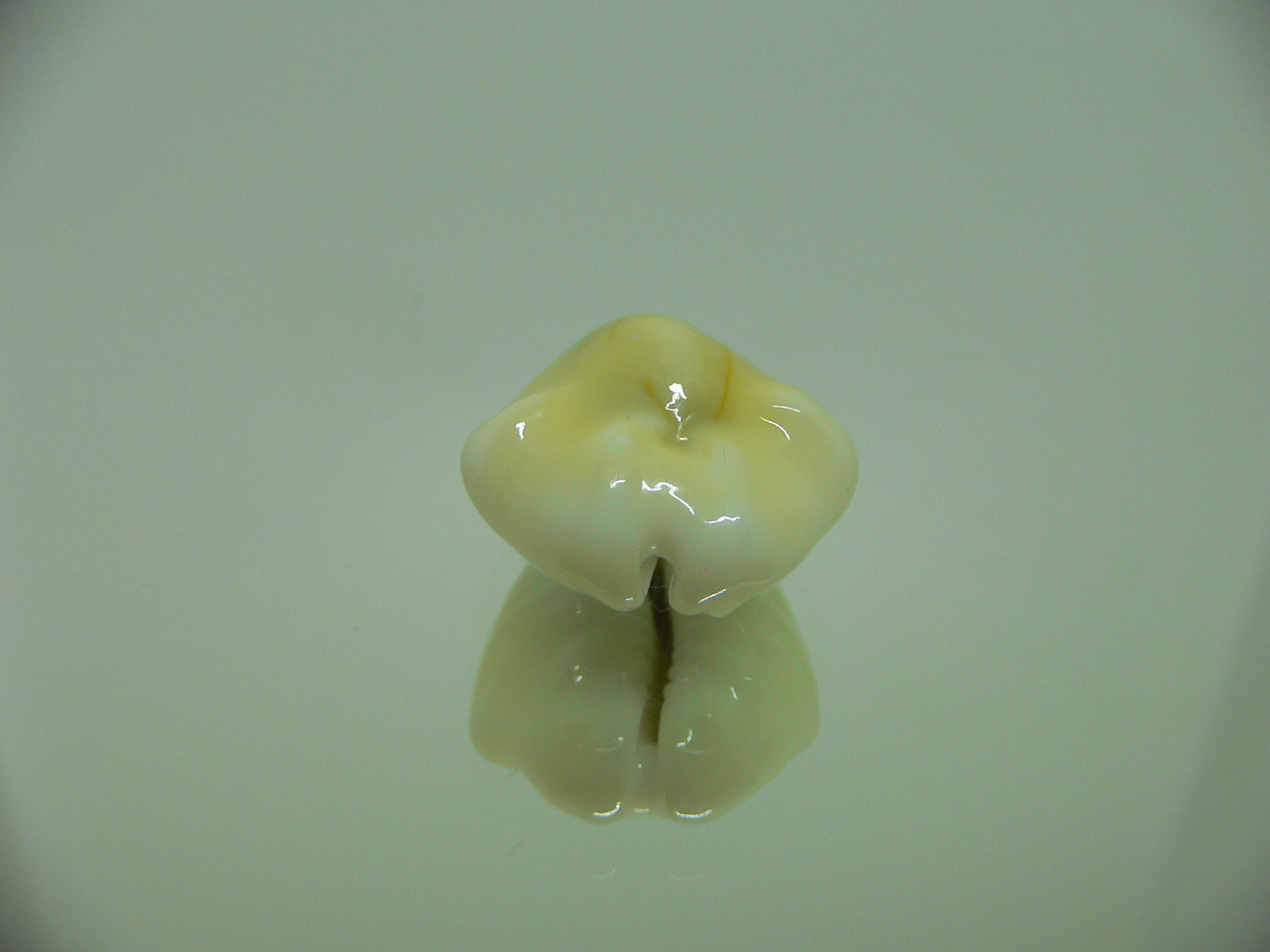 Cypraea moneta tuberculosa (var.) 9