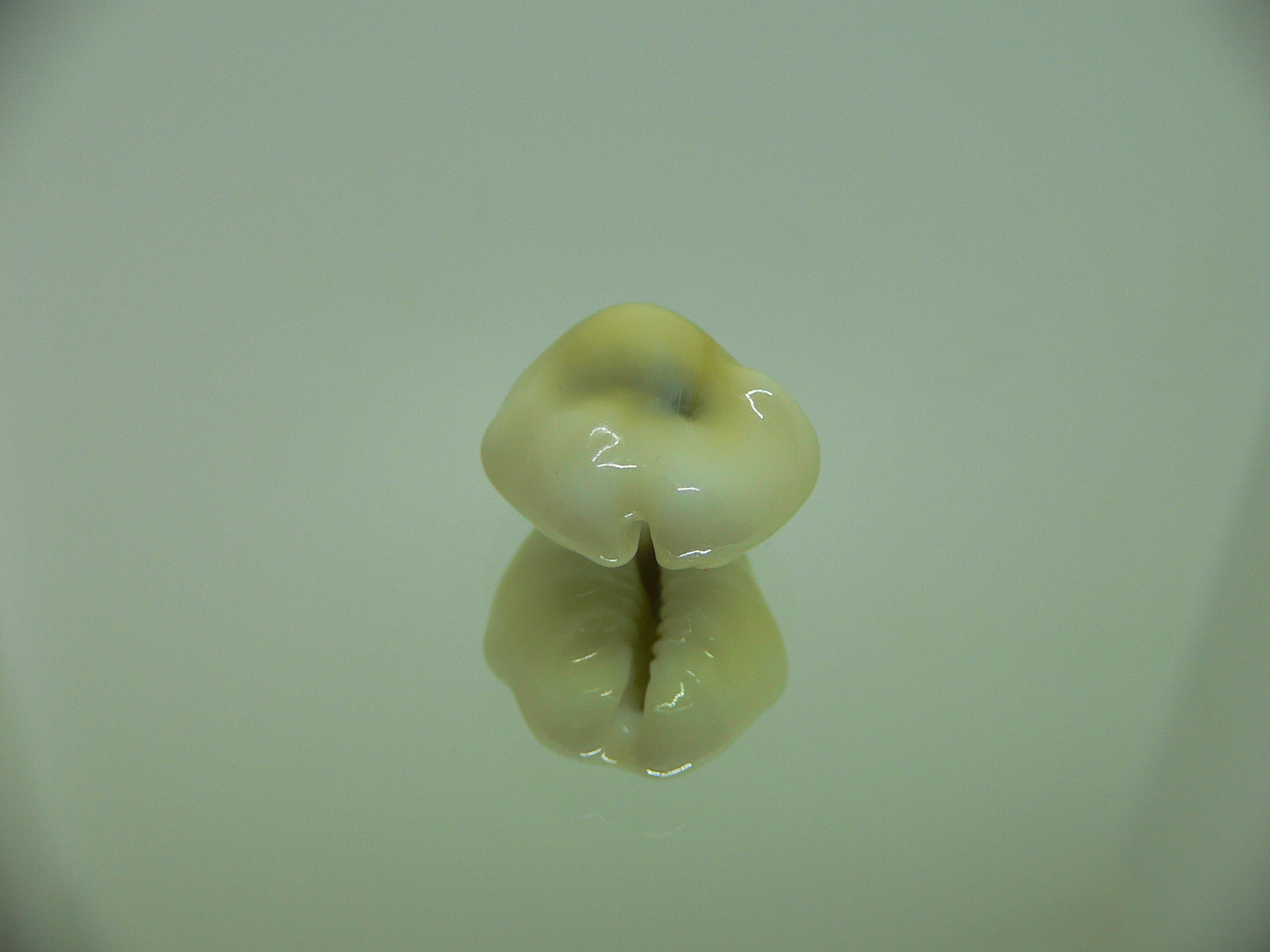 Cypraea moneta tuberculosa (var.) 4