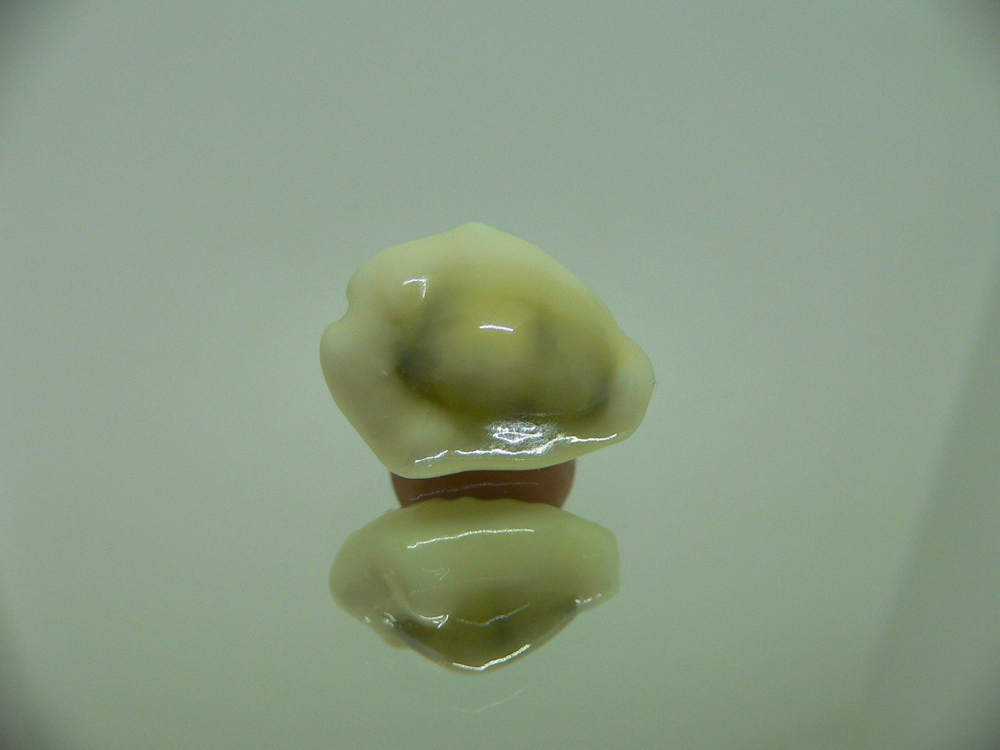 Cypraea moneta tuberculosa (var.) 4