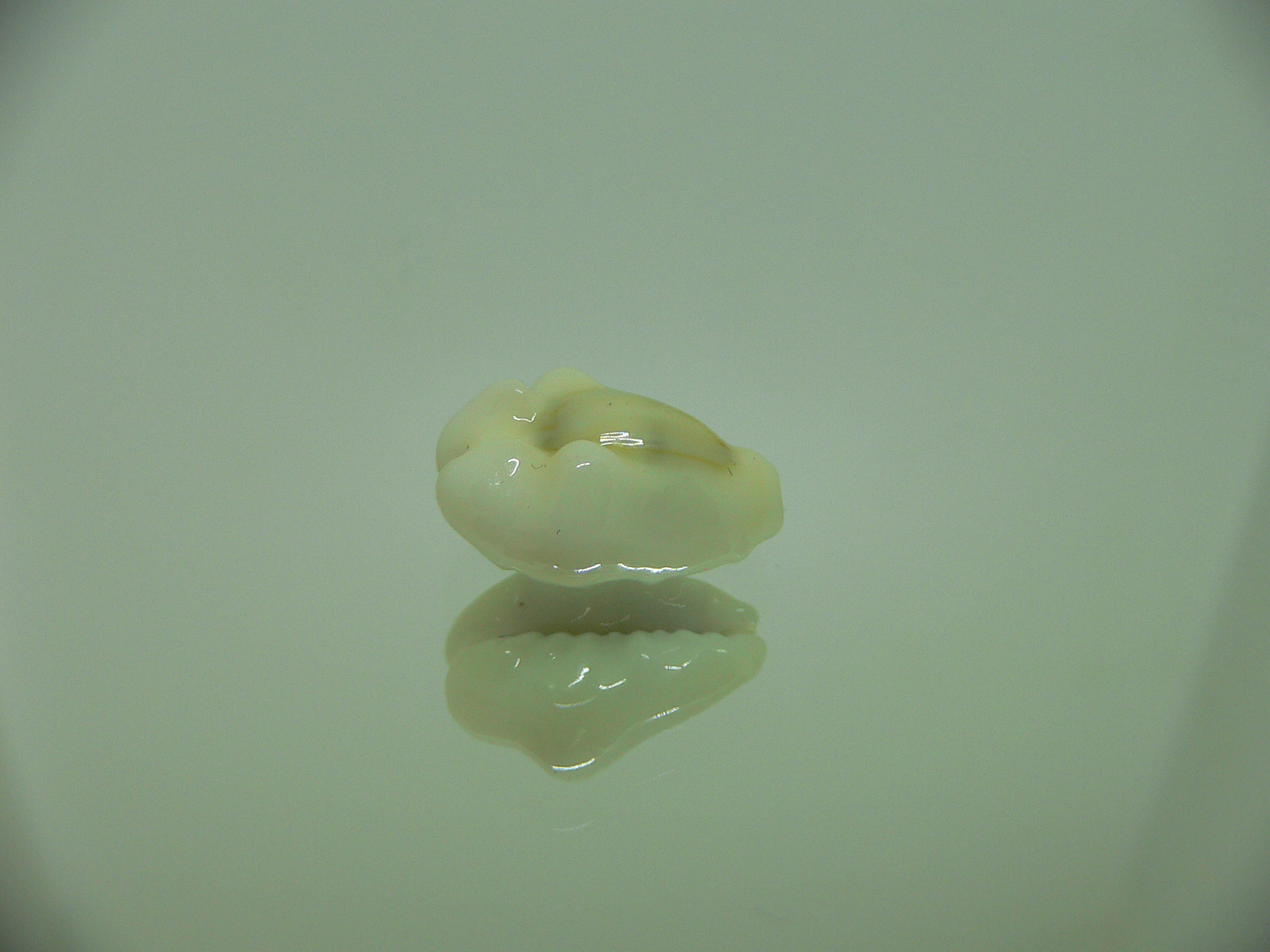 Cypraea moneta tuberculosa (var.) 1