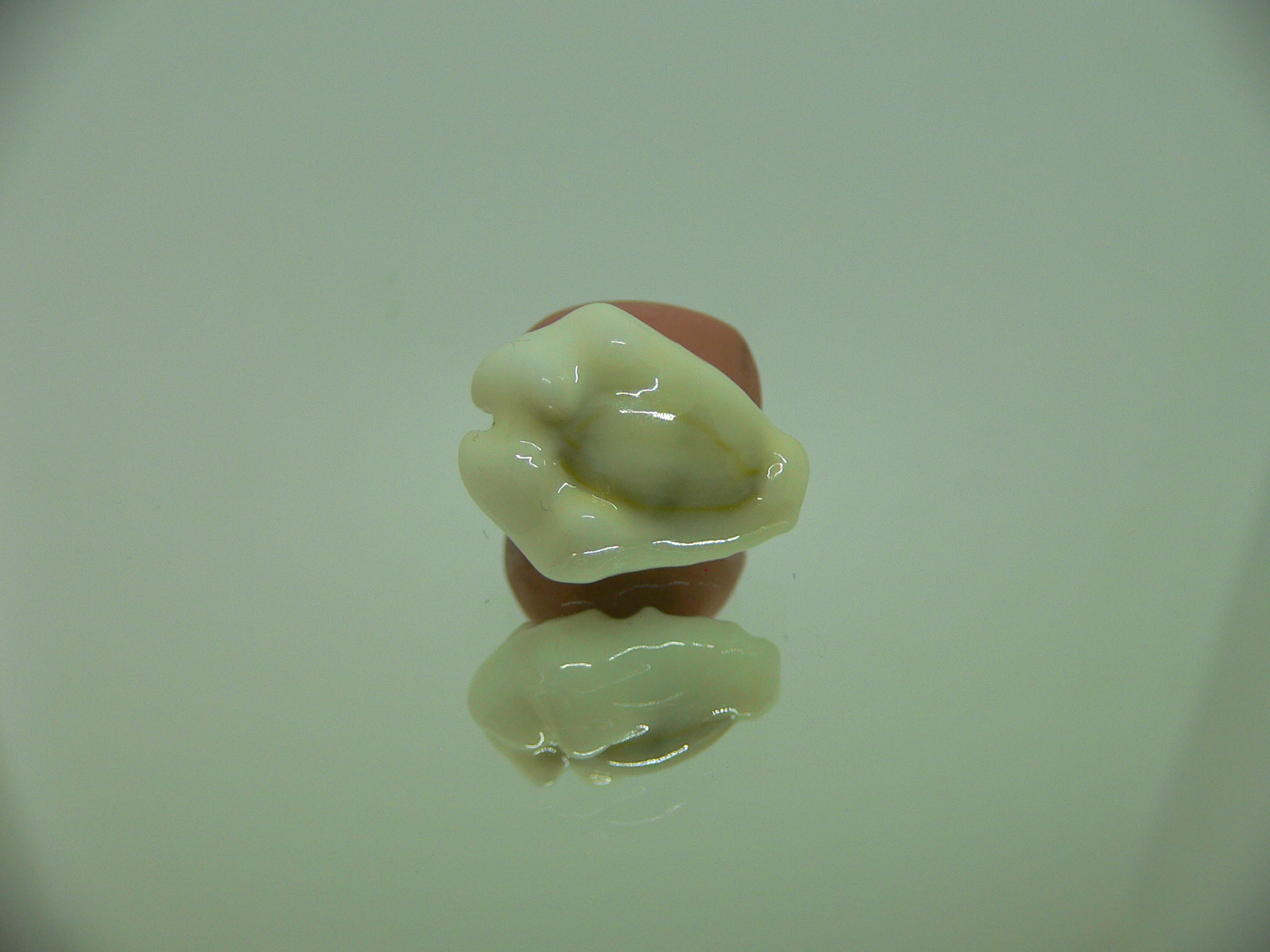 Cypraea moneta tuberculosa (var.) 1