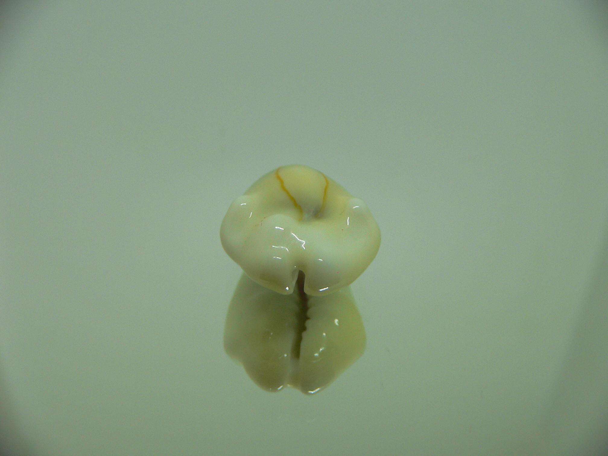 Cypraea moneta tuberculosa (var.) 7