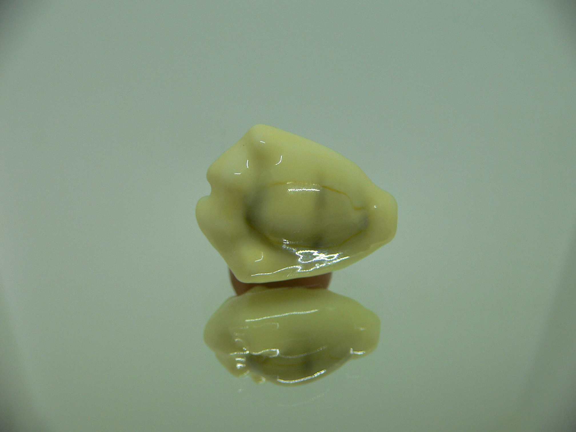 Cypraea moneta tuberculosa (var.) 8
