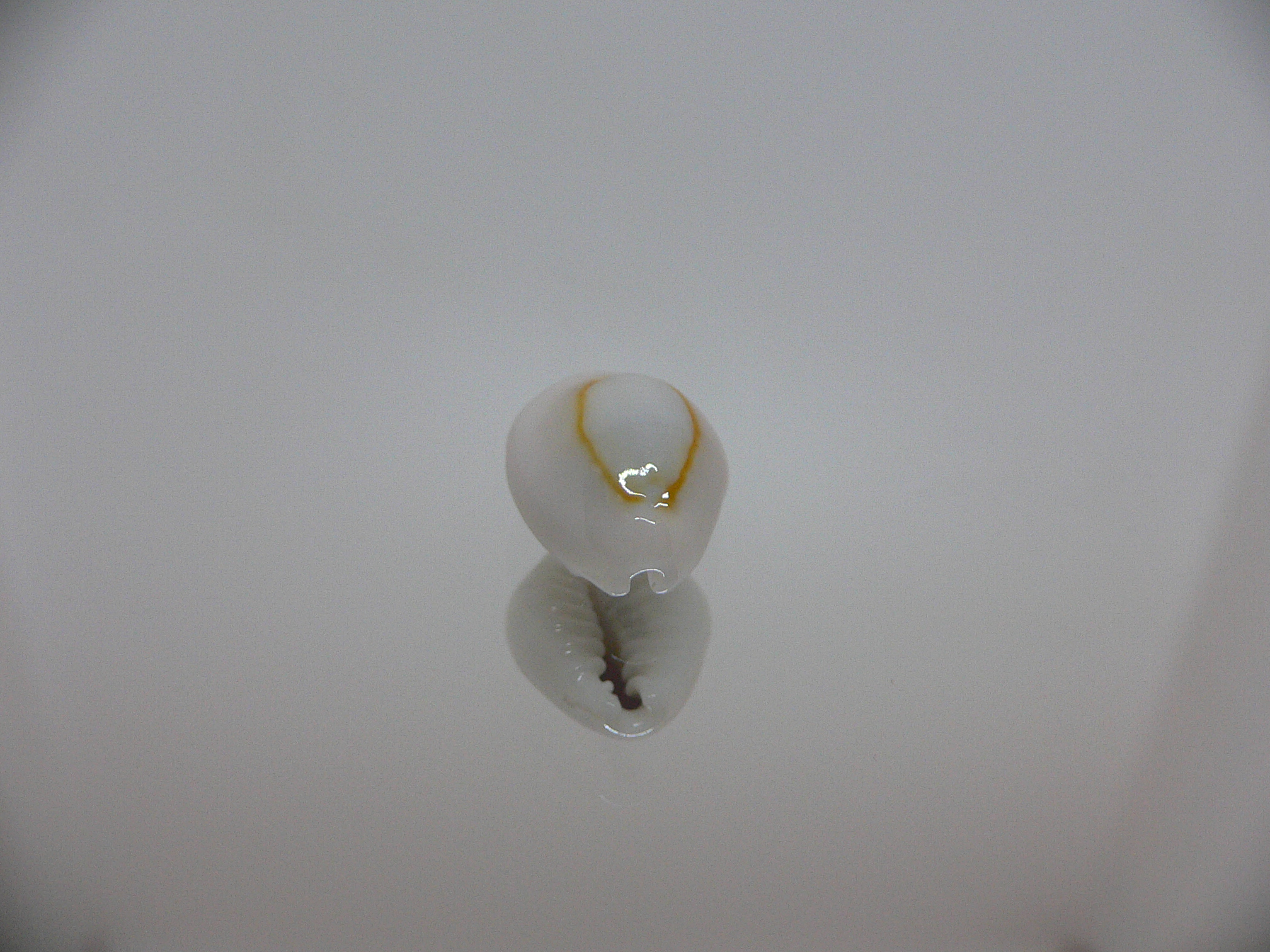 Cypraea annulus sublitorea (var.)