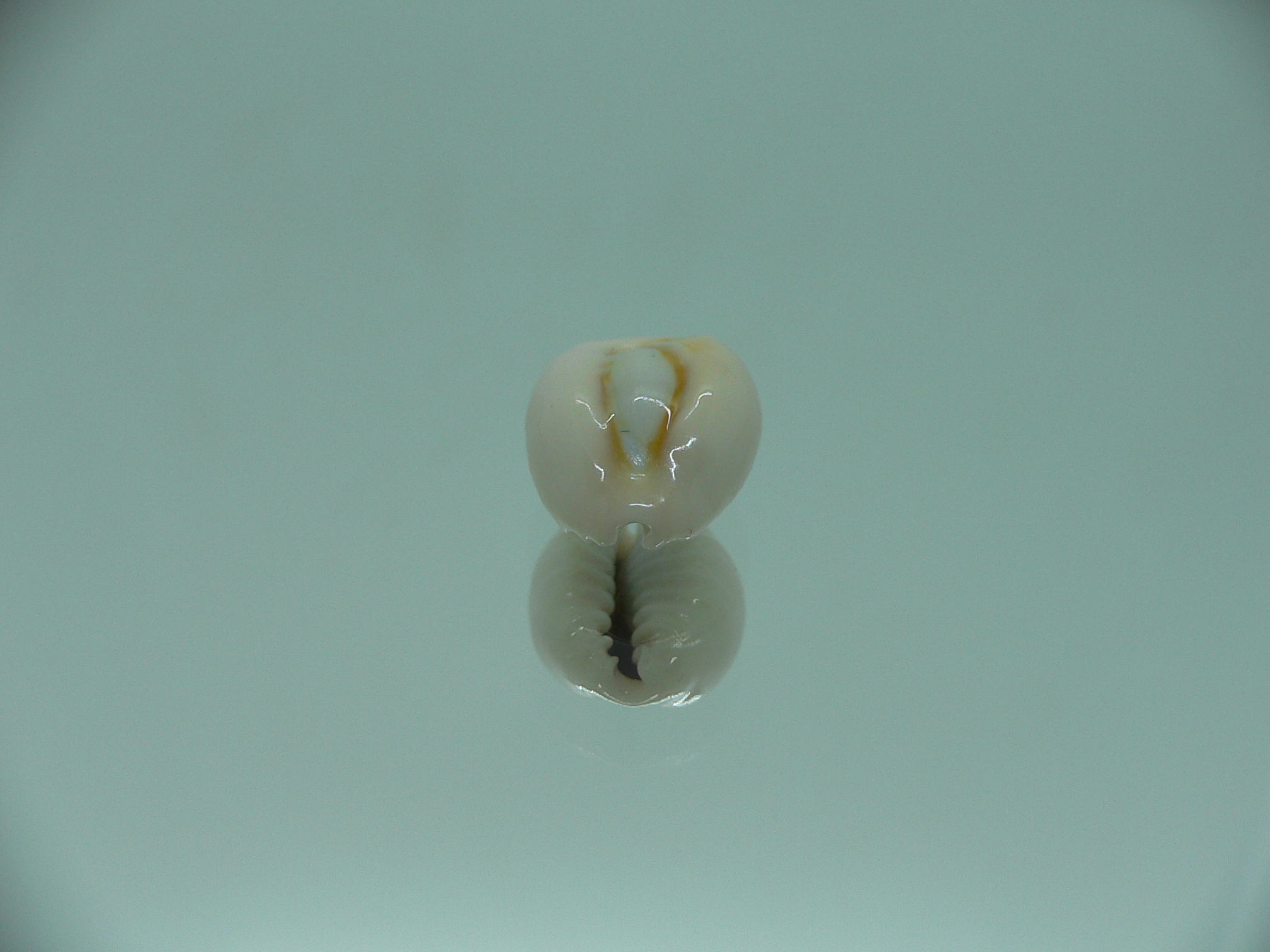 Cypraea obvelata perrieri (var.) BEAUTIFUL