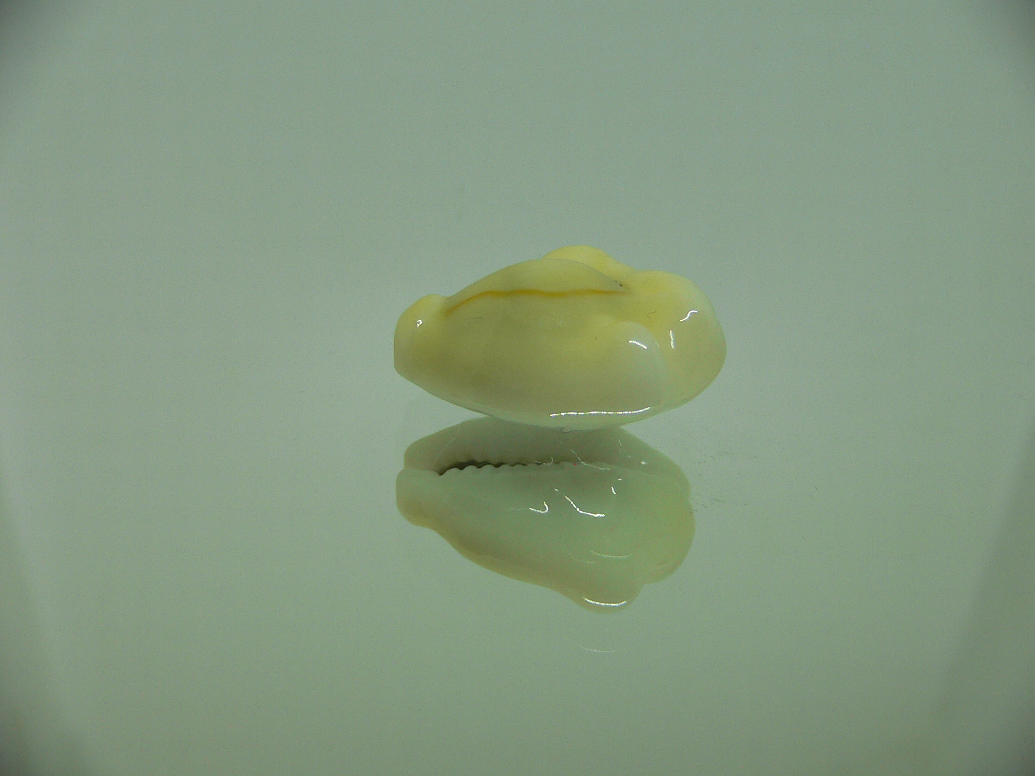 Cypraea moneta tuberculosa (var.) 5