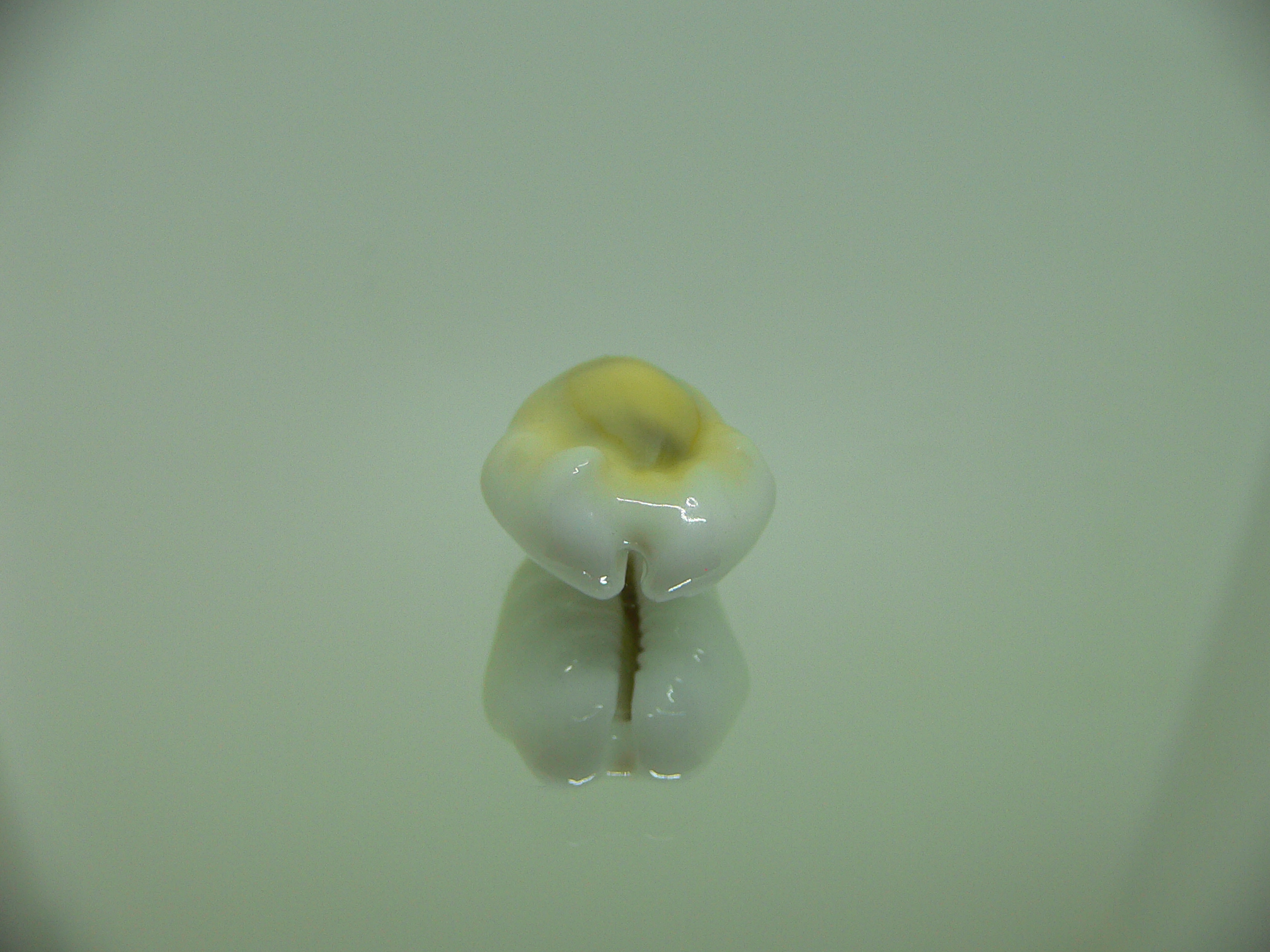 Cypraea moneta tuberculosa (var.) 3