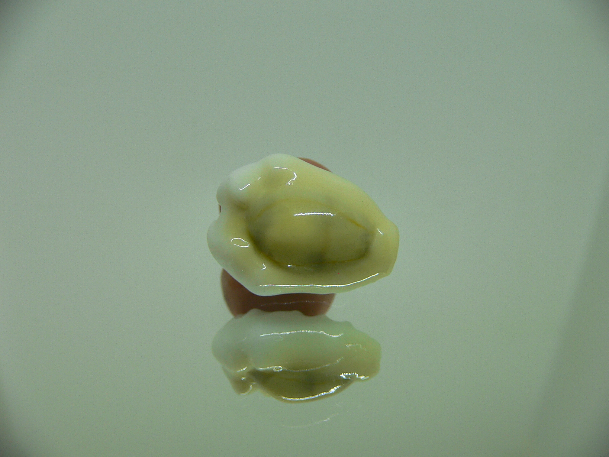 Cypraea moneta tuberculosa (var.) 3