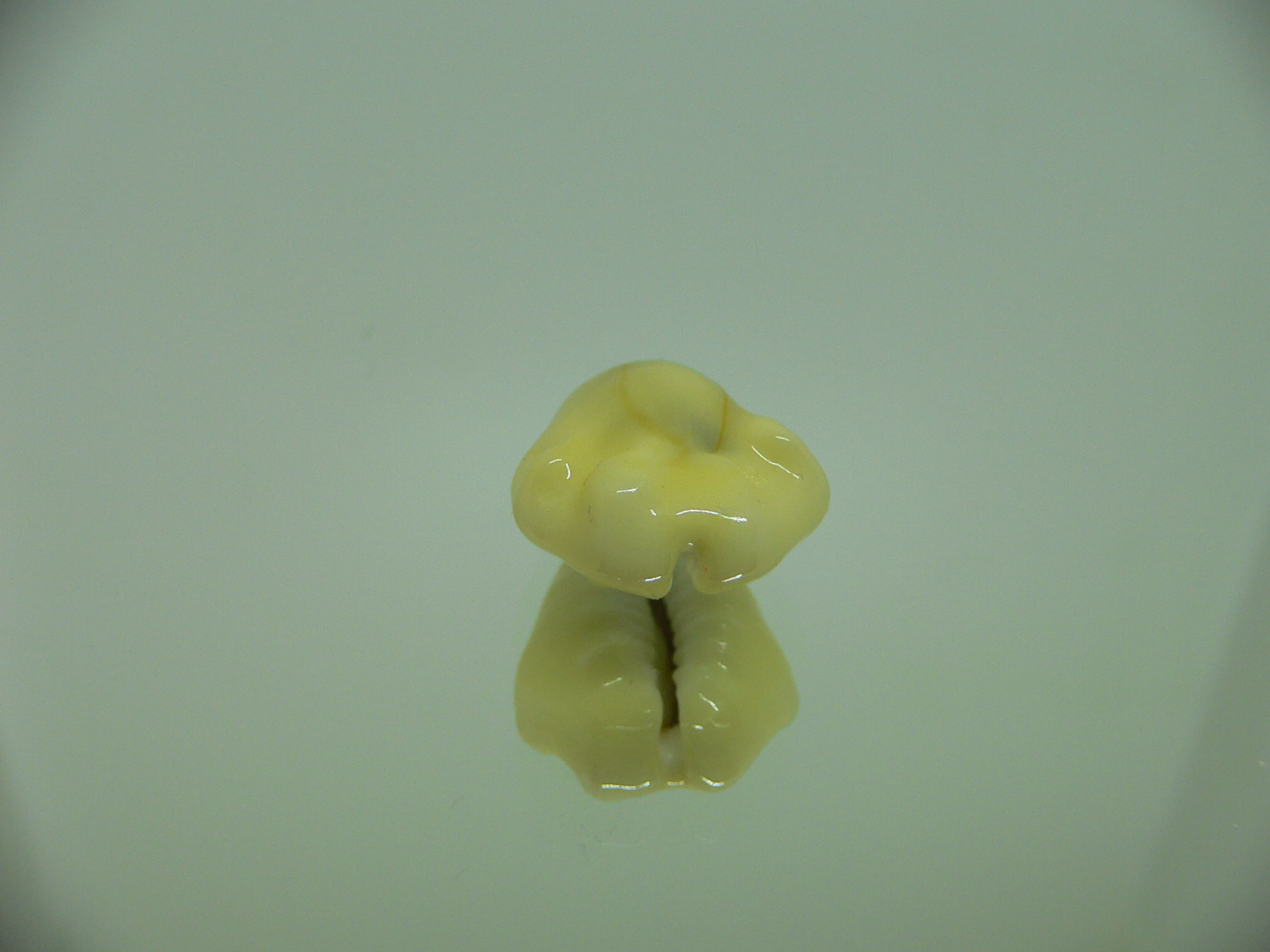 Cypraea moneta tuberculosa (var.) 6