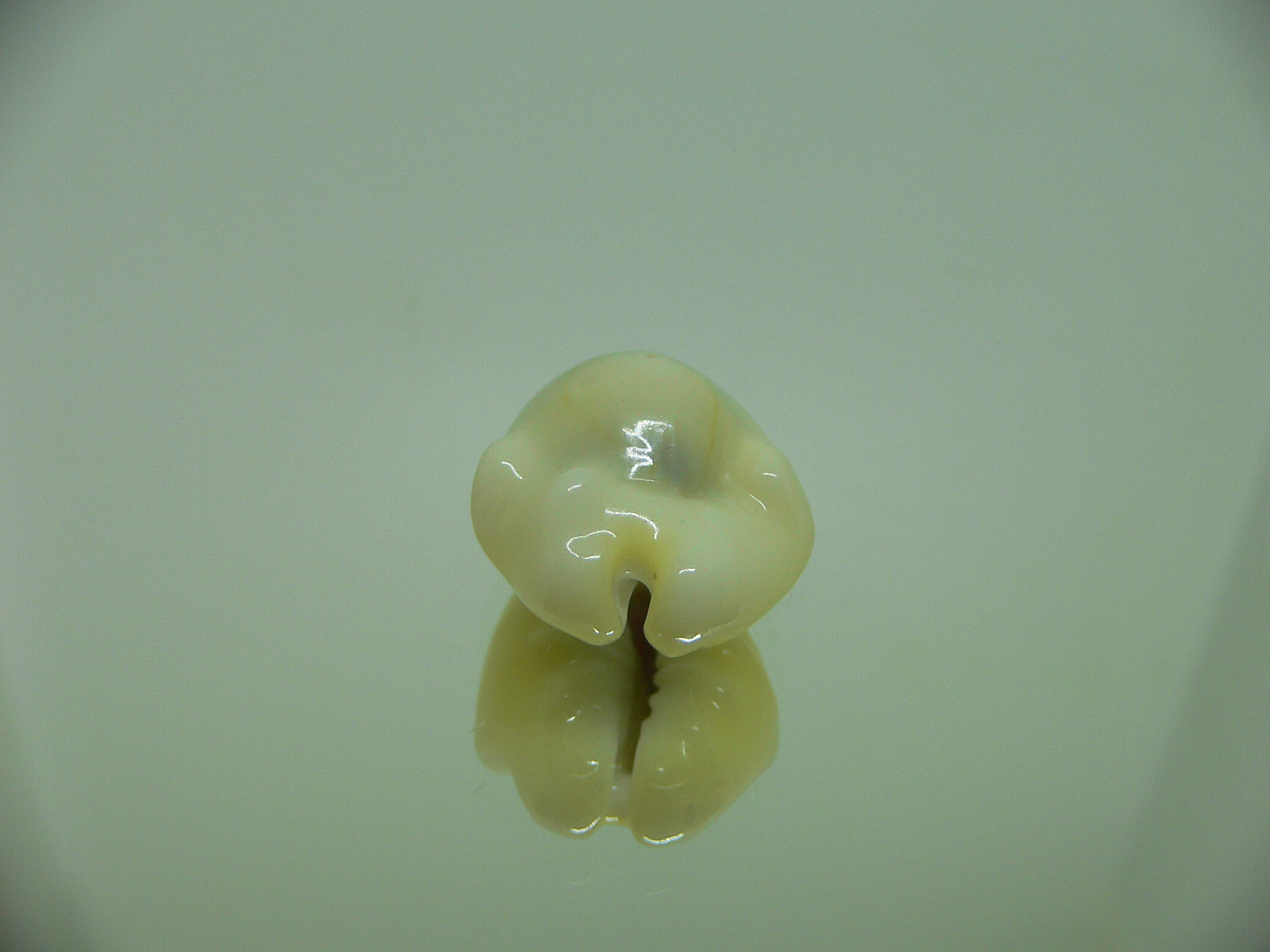 Cypraea moneta tuberculosa (var.) 13